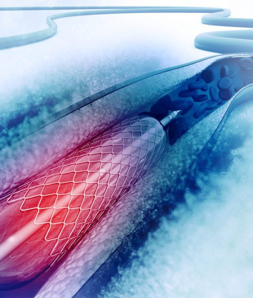 PTFE Medical Coatings Waterbased OneCoat Medical Guidewire Coatings